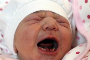 9 dişle doğan bebek herkesi şaşkına çevirdi