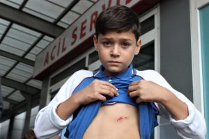 Bursa'da aç kalan köpekler ilkokul öğrencisine böyle saldırdı