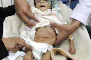 BM'den Yemen'de 'kıtlık riski' uyarısı