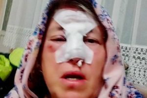 Annesine boynup atıp yaralayan koçu kesti