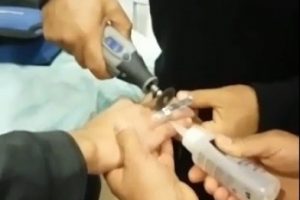 Parmağına sıkışan yüzüğü itfaiye çıkardı