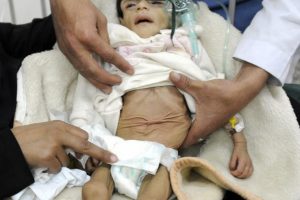 Yemen'de 10 milyon insan için kırmızı alarm