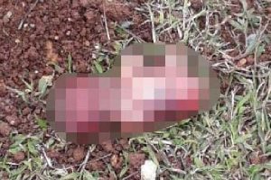 Parkta çocuk cenini bulundu!