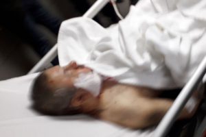 Bursa'da görme engelli adama bıçaklı saldırı