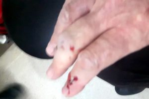 Bursa'da taksi şoförü, gasp girişiminde silahla yaralandı