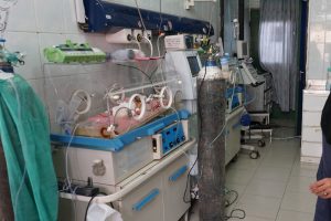 Yemenli yapışık ikizler kurtarılamadı
