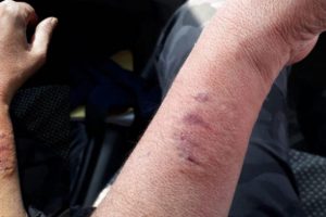 Polisin kolunu ısıran HDP'li vekil hakkında flaş gelişme