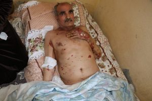 Ağzının içi dahil her tarafında çıkan yaralar hayatını kabusa çevirdi