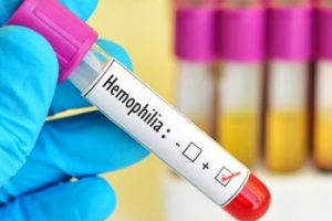 Hemofili hastalarına yaşam kalitesini artıracak öneriler