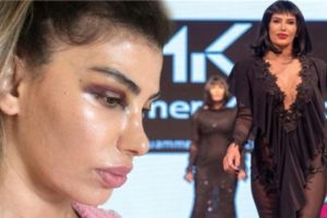 Hatice'nin gözü morardı