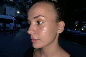 Site sakini kadınla servis şoförünün ''kedi ezme'' kavgası