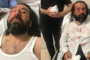 İYİ Parti'nin kurucusu Metin Bozkurt'a saldırı!