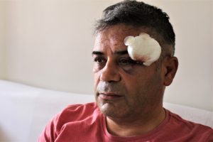 Bursa İYİ Parti grup başkan vekili saldırıya uğradı