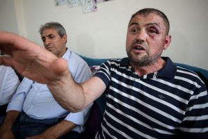 Bursa Büyükşehir Belediyesi gazinin darbedilmesiyle ilgili harekete geçti