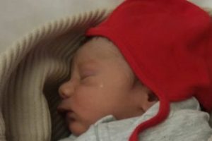 Leo bebek ameliyat oldu