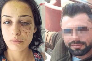 Genç kadının yüzünü tanınmaz hale getirdi, serbest bırakıldı