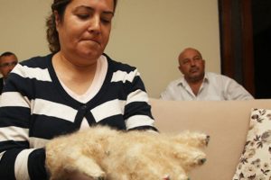 'Raynaud fenomeni' hastası tiftik eldivenlerine kavuştu