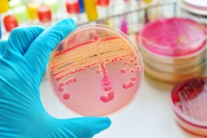 Bilinçsiz antibiyotik kullanımı sepsis tedavisini güçleştiriyor