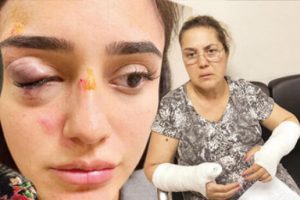 Ünlü manken ve annesi böyle darp etmiş!