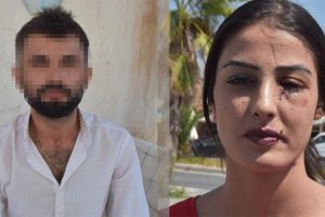 Yüzünü şişeyle parçaladı! ''Yeni bir kimlikle başka şehirde yaşamak istiyorum''