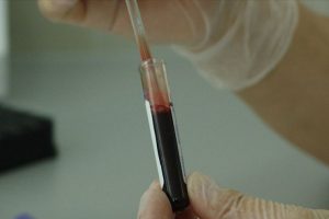 'Sepsiste erken tanı ve tedavi çok önemli'
