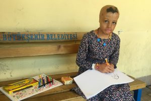 Yüzü yanan Evin'e kendi dokusundan cilt yapılacak