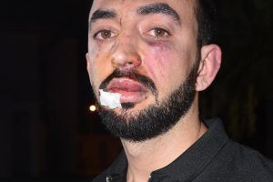 İyilik yapmak isterken canından oluyordu