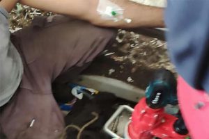 Bacağı çöp öğütücü makineye sıkıştı!