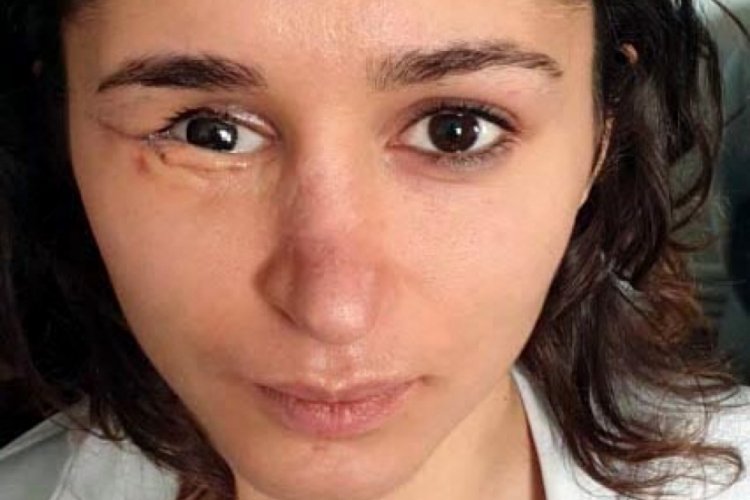 Tuğçe'nin yüzünün parçalandığı tüfekli saldırı davası ağır cezada