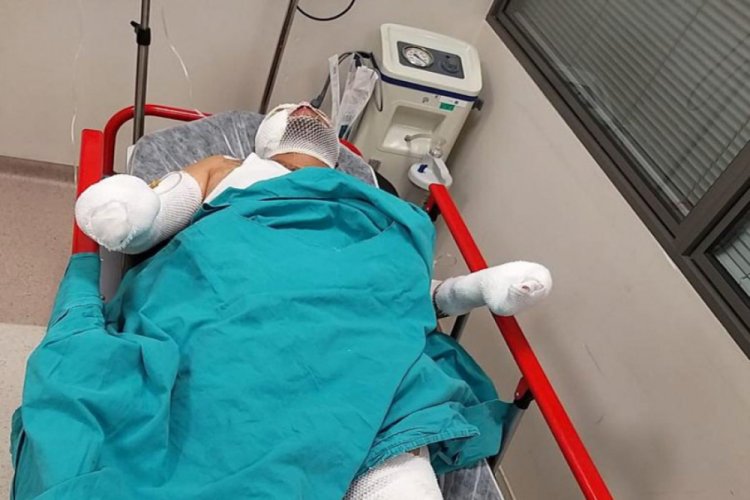 Evi yakmak isterken kendini ve arkadaşlarını yaktı