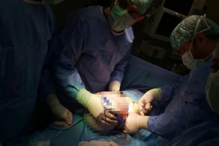 Karnından 4 kiloluk tümör çıktı