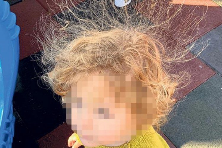 Diken diken saçın suçlusu 'kauçuk'