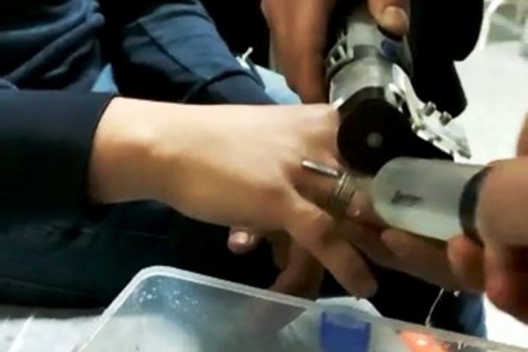 Parmağına sıkışan yüzüğü, ekipler çıkardı