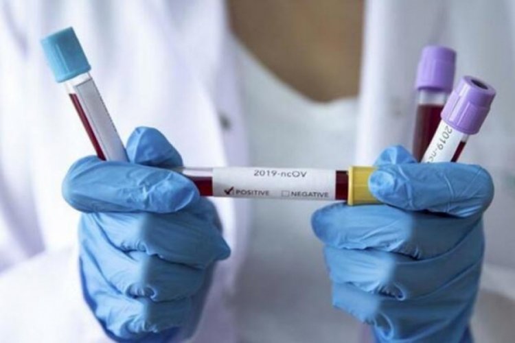 Çin'de yeni tip koronavirüs salgınında ölü sayısı 3 bin 213 oldu