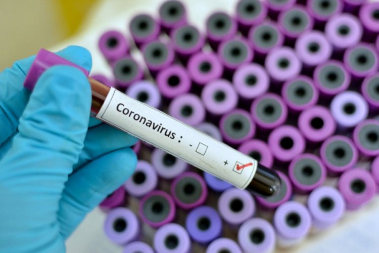 Liberya'da ilk koronavirüs vakası görüldü