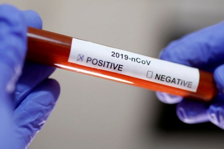 ABD ordusunda test sonucu pozitif çıkan kişi sayısı 37'ye çıktı