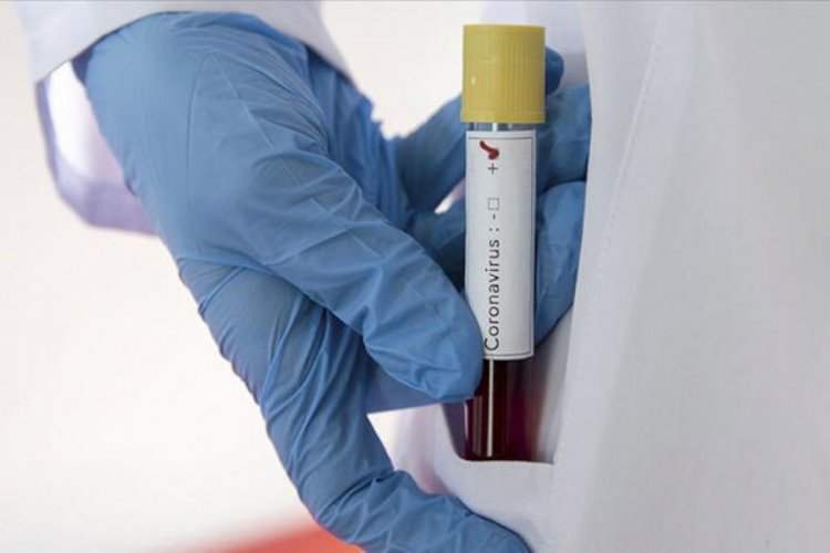 Roche üçüncü faz anti Covid-19 ilaç testlerine başlıyor