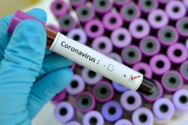 Düşük maliyetli ve hızlı sonuç veren test kiti geliştirildi