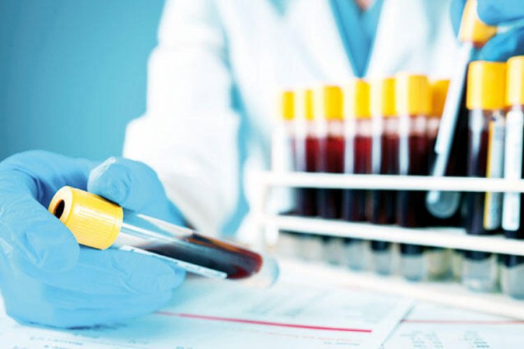 Şimdi de test simsarları ortaya çıktı!