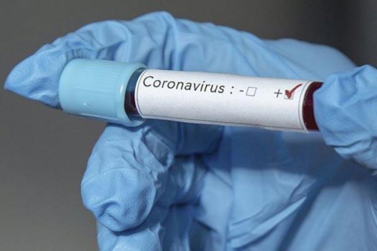 Afrika'da koronavirüs vakaları 8 bin 500'ü geçti