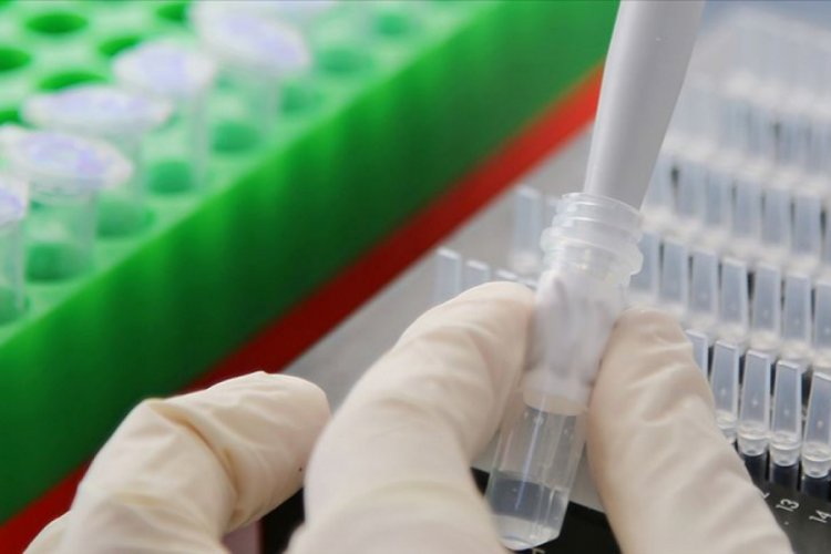 DSÖ'den virüsün laboratuvarda üretildiğine ilişkin açıklama!