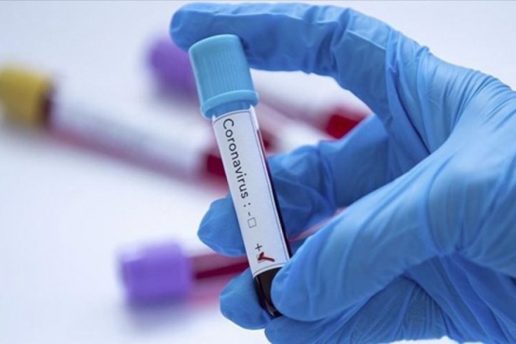 Covid-19 testi pozitif çıkan kişi doğum günü partisinde yakalandı