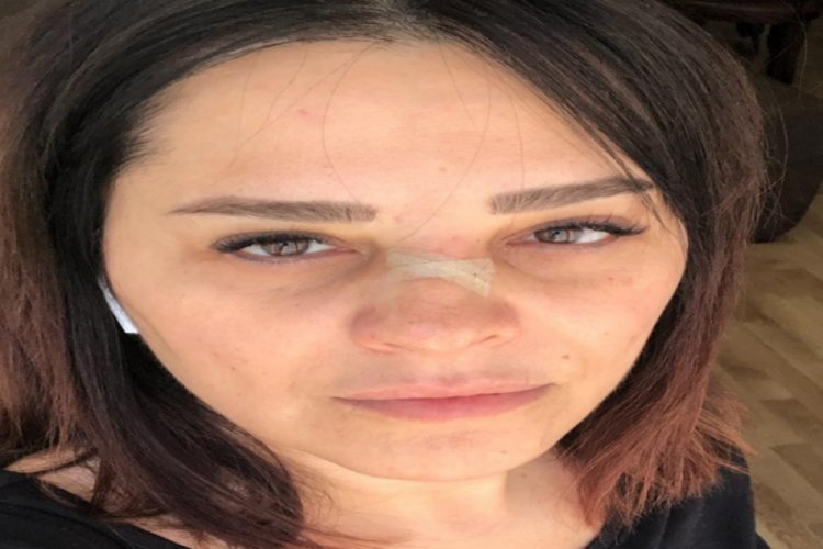 Reyhan Karaca'nın burnu kırıldı