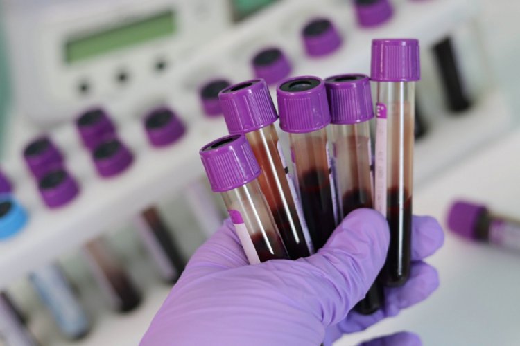 Çin'de kanseri belirtiler görülmeden tespit eden test geliştirildi