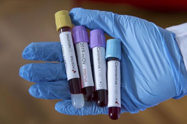 Strasbourg'da 5 oyuncuda koronavirüse rastlandı