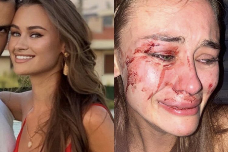 'Ünlü model güvenlik görevlilerin saldırısına uğradı' iddiası