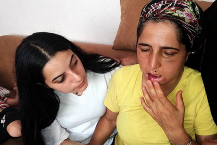 'Çok korkuyorum demişti' 22 yıldır şiddet gören Hatice'nin eşi tutuklandı