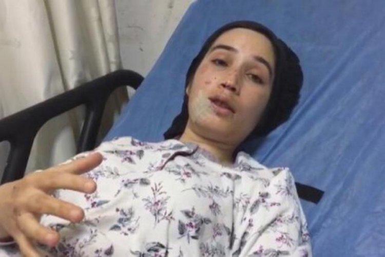 Otobüs kazasında yaralanan kadın: Şoför acele ediyordu, biraz da hızlı sürüyordu
