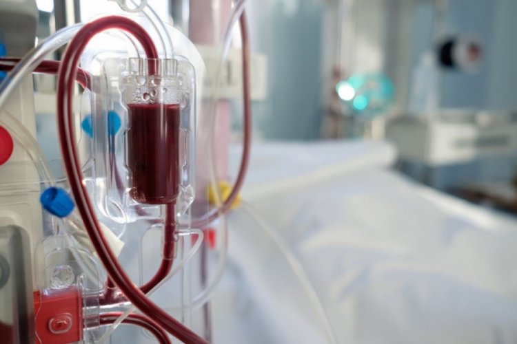 Corona virüs tedavisi için yeni yöntem: Kan temizleme