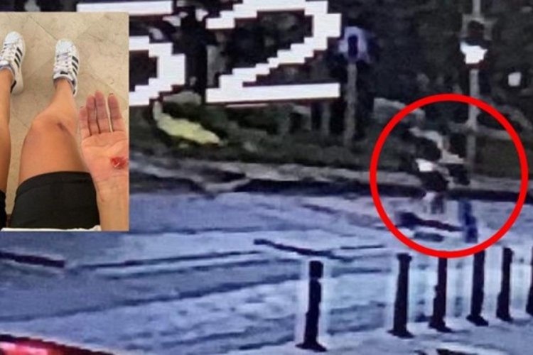 İşe giderken köpeklerin saldırısına uğradı